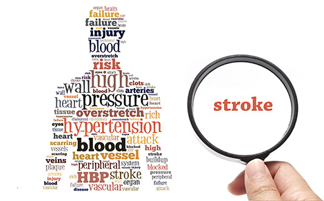Stroke risk word cloud depicting a person's risk of stroke from atrial fibrillation