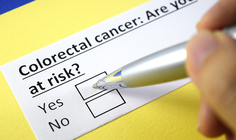 Colon Cancer