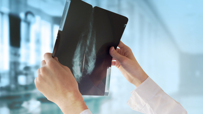 Breast Imaging Fellowship at MetroHealth GME