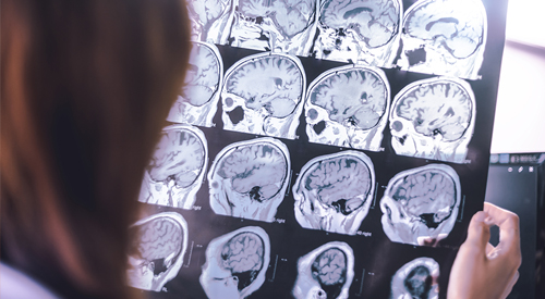 Neurology