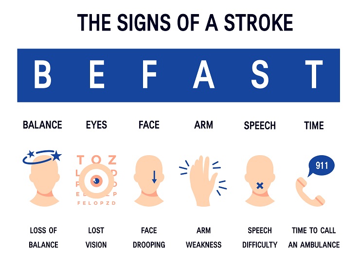 stroke symptoms face