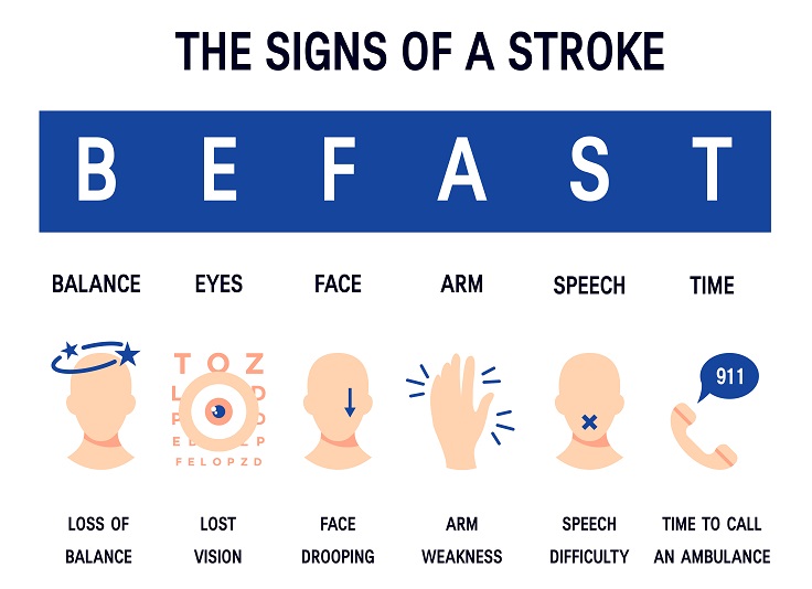 Graphic illustrating the signs of a stroke: balance, eyes, face, arm, speech, time