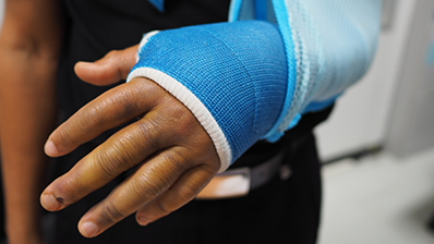 Boy with broken arm in blue cast