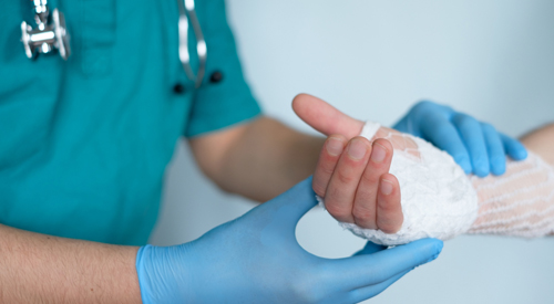 Hand Injury