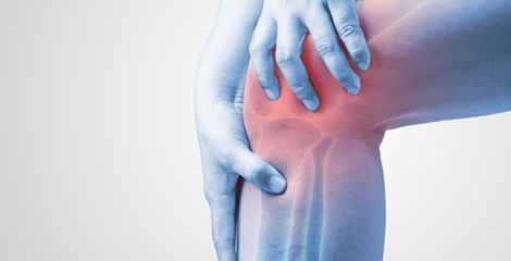 Medical illustration of knee pain