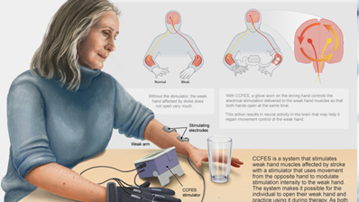 Research at The MetroHealth Rehabilitation Institute