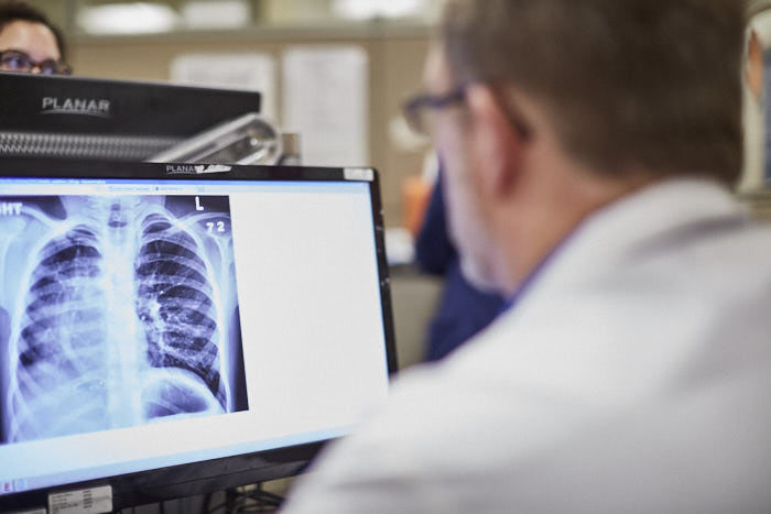 Doctor Viewing X-Ray