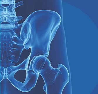 X-ray image of a hip bone