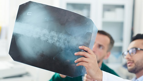 Doctor holding up xray of spine