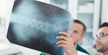 Doctor holding up xray of spine