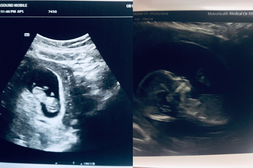 adrian-lii-bell-ultrasound