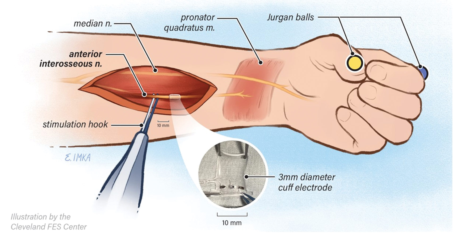 Medical illustration