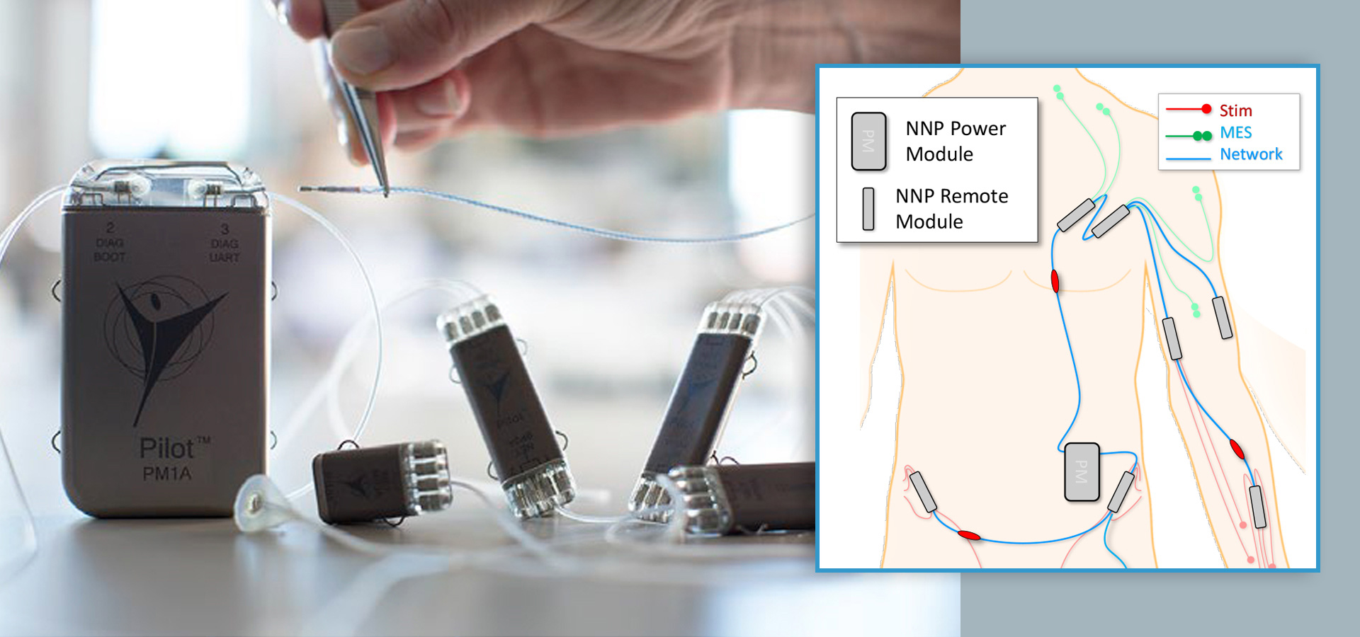 Networked Neuroprosthesis