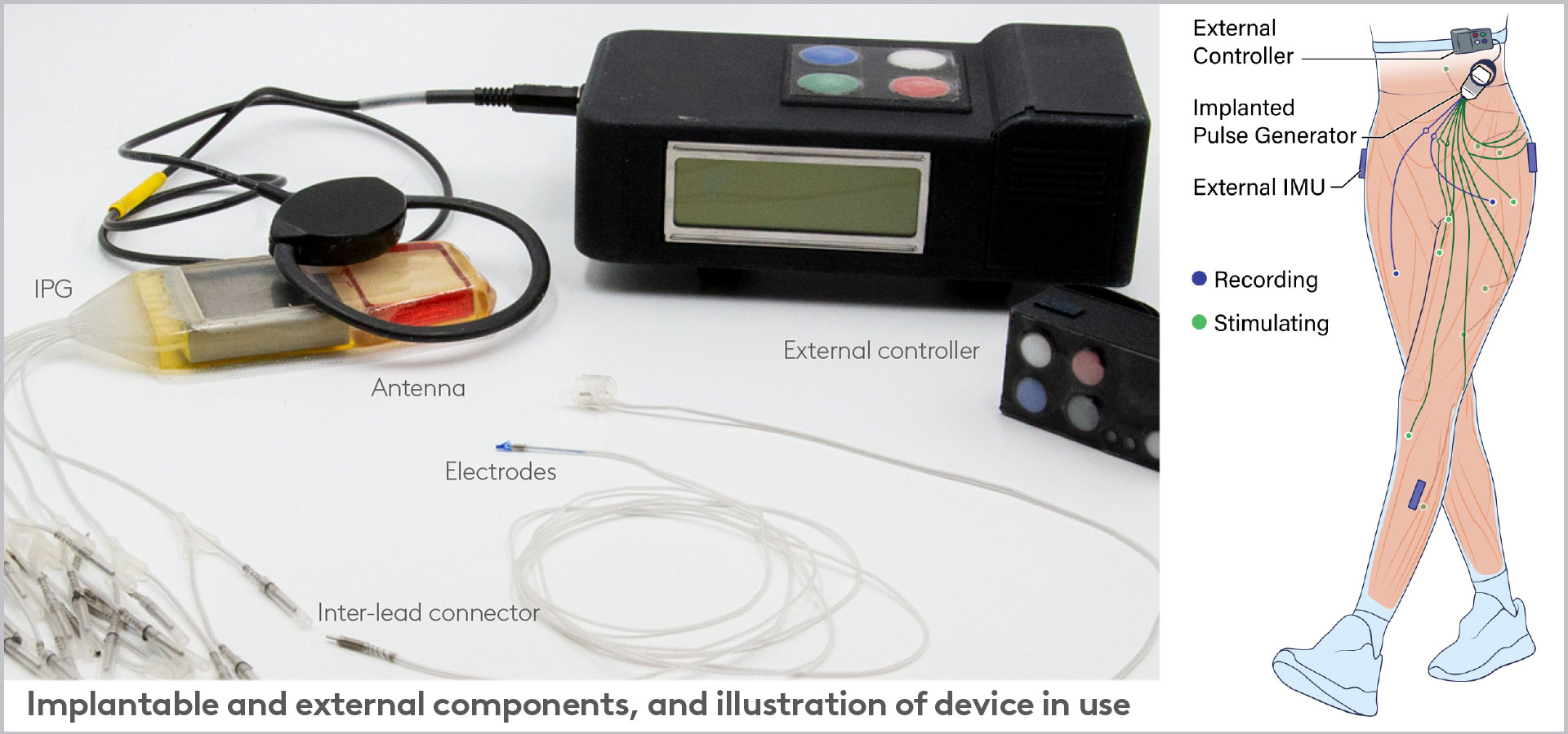 Technology that can help with Stroke recovery