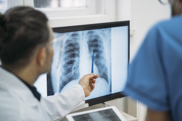 Doctors analyzing an x-ray image of a chest
