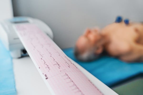 An EKG heart monitor printout