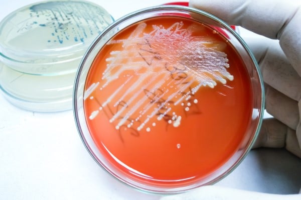 A petri dish with a bacteria sample