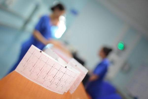 An EKG printout with doctors in the background