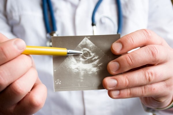 A doctor holding an ultrasound image of a heart 