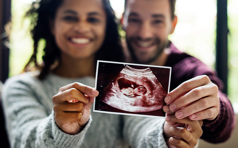 Parents-to-be holding an ultrasound image of their baby