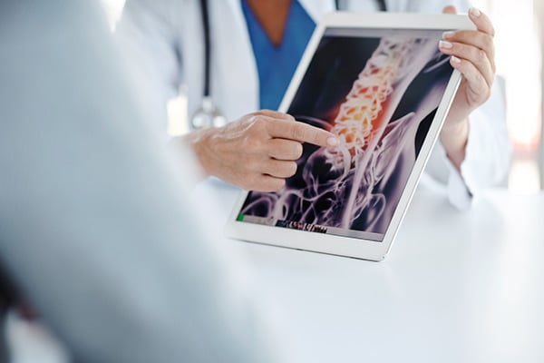 A researcher pointing to an image of a spine