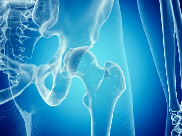 hip scan image