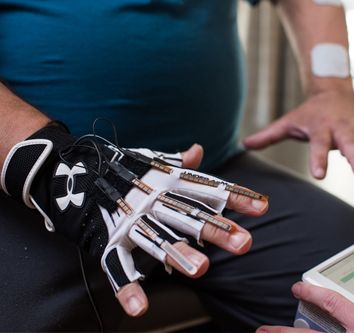 Patient receiving hand therapy via electrical stimulation